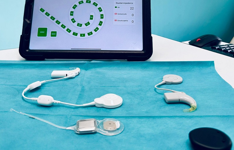 Impianto Cocleare Smart