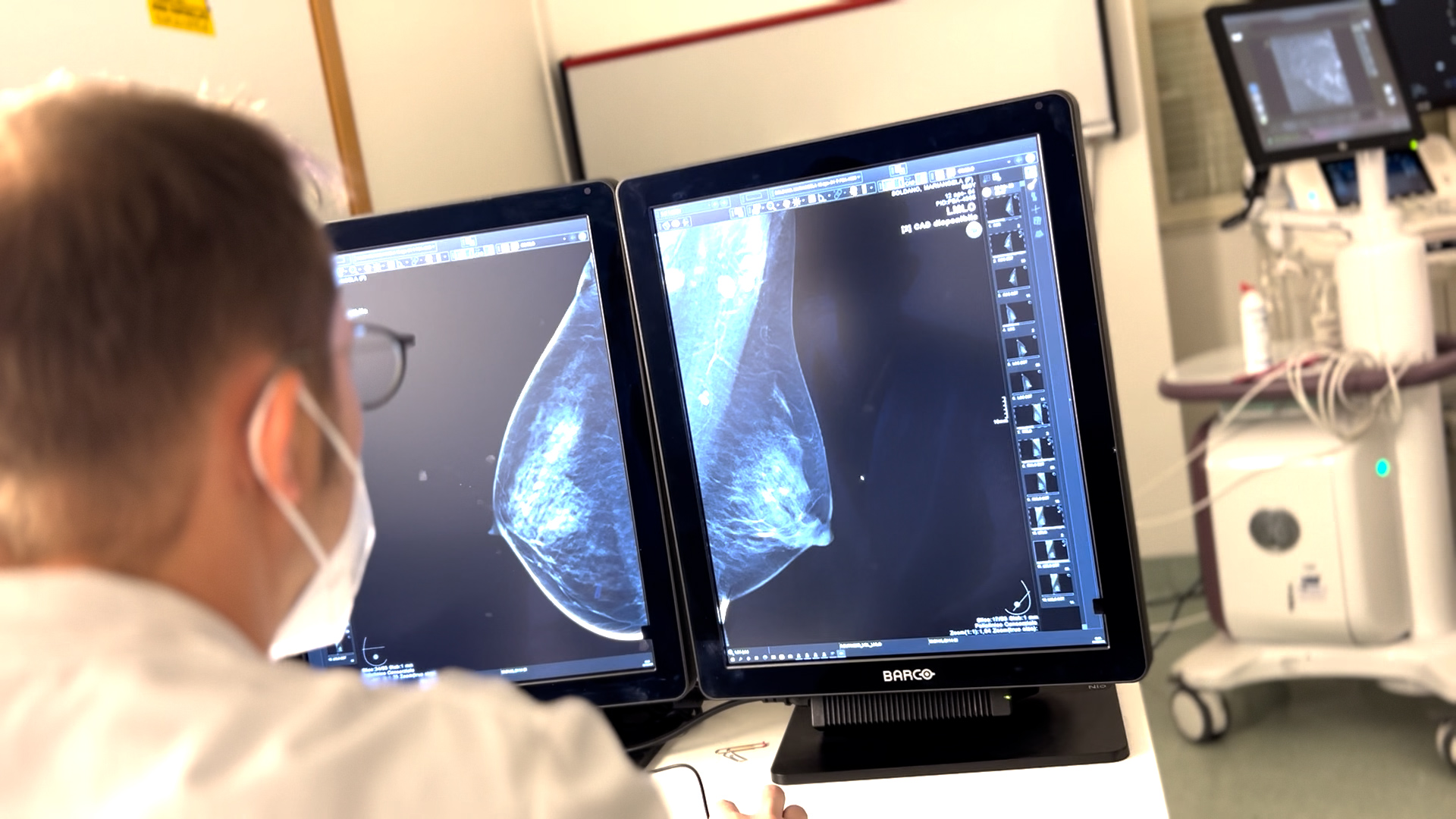 Ecografia Senologia (1)