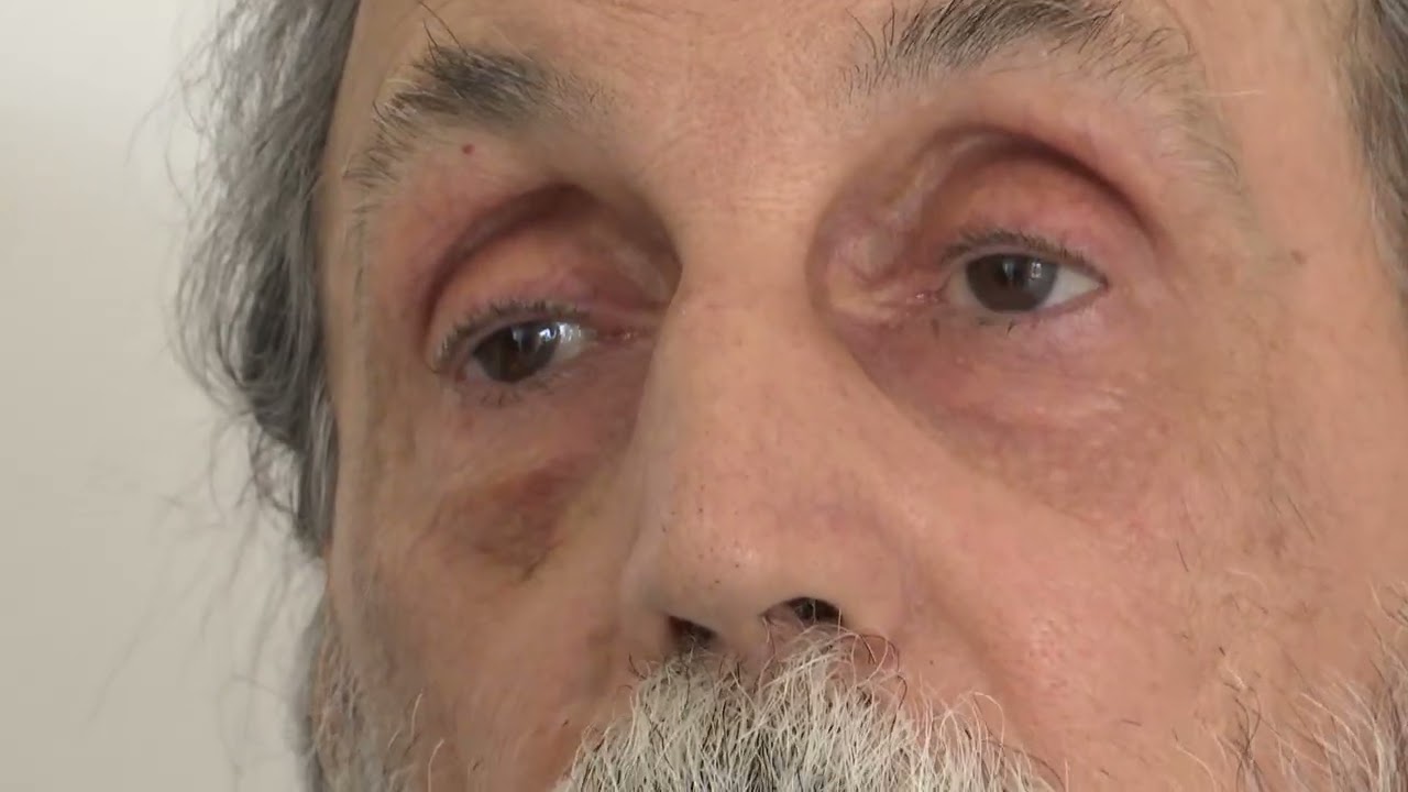 Premio “tommaso Francavilla”, Vince Telebari Con La Storia Di Lorenzo: L’ex Clochard Diventato Poeta – Video