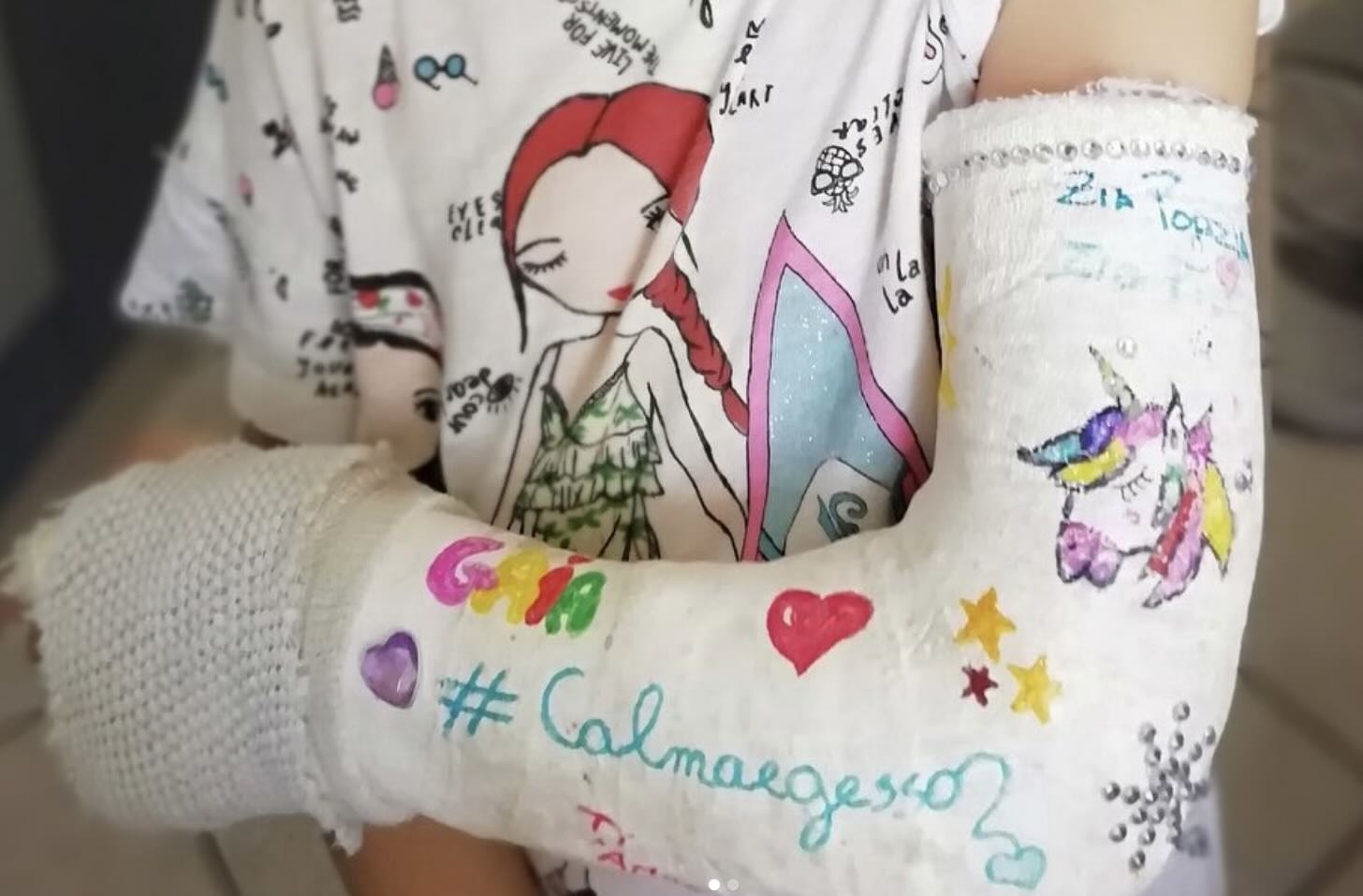 Gesso Bambino Ospedale